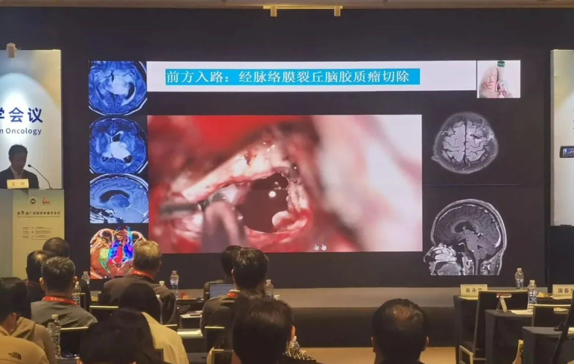 钨金针型电极、、刮吸照明电极等产品参展2024第十一届昭通国际肿瘤学会议